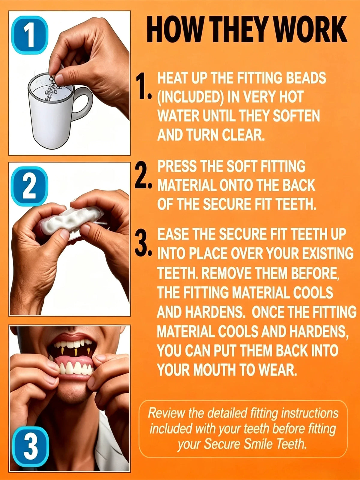 Cosmetic Smile Veneers for Upper and Lower Teeth
