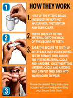 Cosmetic Smile Veneers for Upper and Lower Teeth