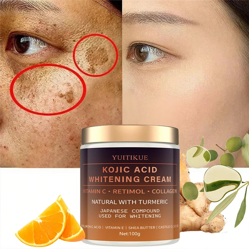 Kojic Acid Whitening Cream with Vitamin C and Turmeric for Face and Body
