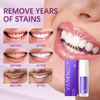 Brightening Teeth Whitening Foam for Oral Hygiene and Stain Removal