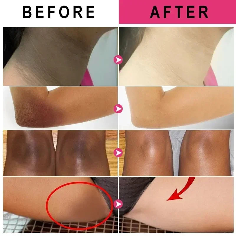 Vitamin C Skin Brightening Cream for Dark Spots and Underarms