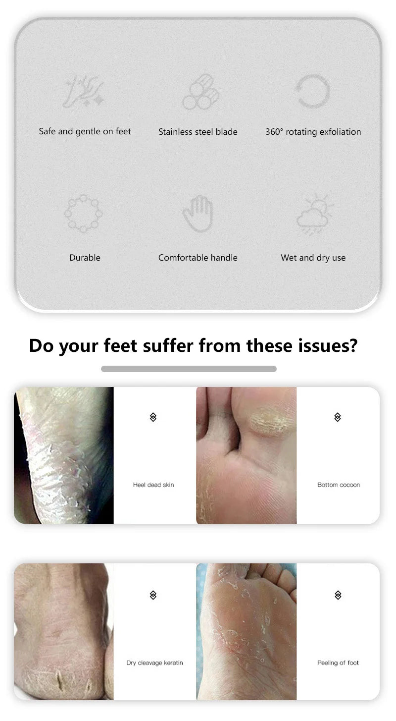 Professional Stainless Steel Foot File for Callus and Dead Skin Removal