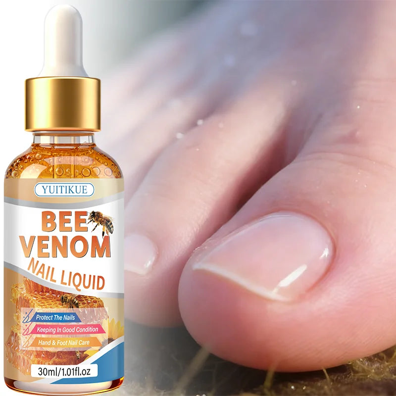 YUITIKUE Bee Venom Nail Treatment Liquid for Hand and Foot Nail Care