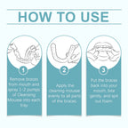 Foaming Aligner and Retainer Cleaner for Fresh Breath