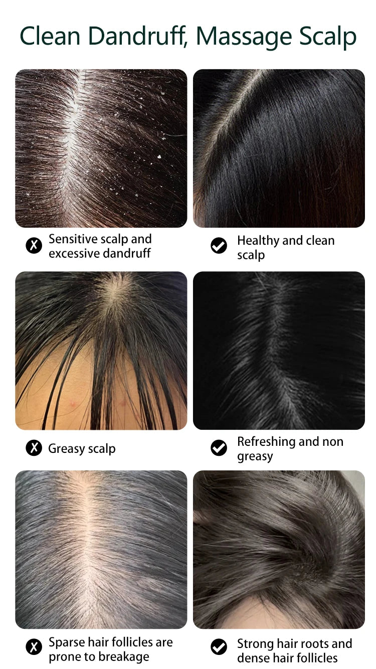 Electric Waterproof Scalp Massager for Stress Relief - 12