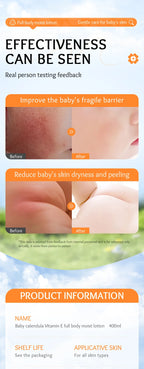 Sadoer Calendula Vitamin E Body Lotion Moisturizing Kids Cream 400ml