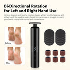 Electric Callus Remover for Smooth Feet and Heel Care