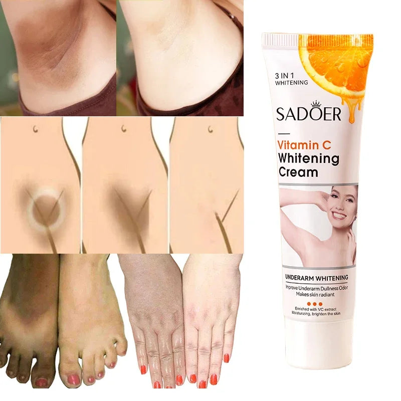 Vitamin C Skin Brightening Cream for Dark Spots and Underarms - 1