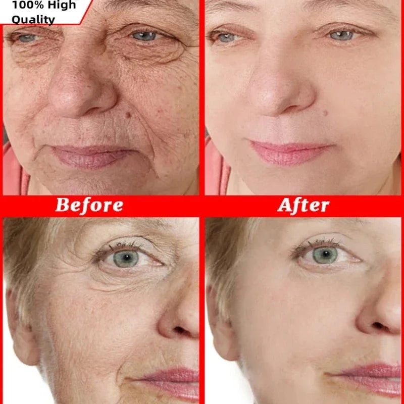 Anti-Aging Face Cream for Wrinkle Reduction and Skin Firming - 2