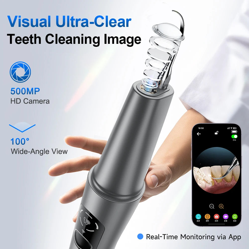 Visual Ultrasonic Tooth Cleaner with HD Camera for Tartar Removal - 2