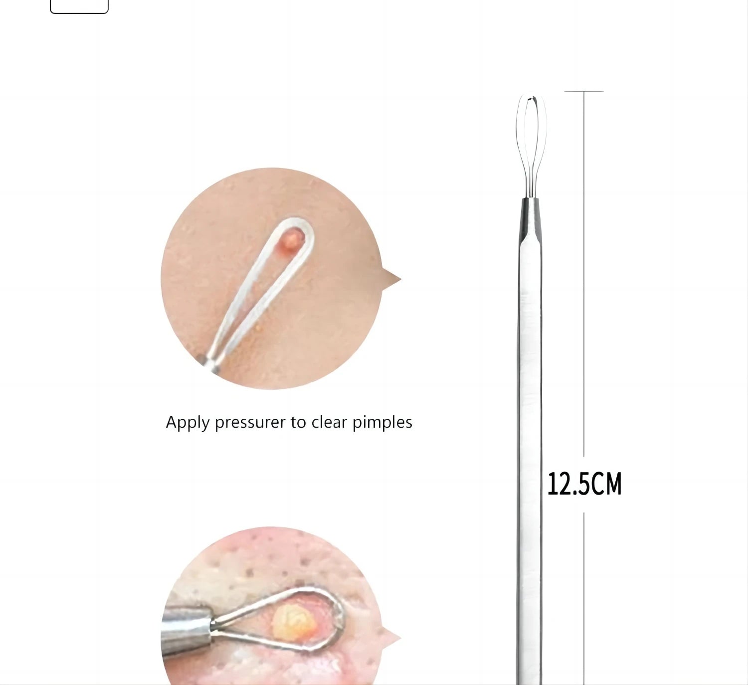 Professional Stainless Steel Blackhead and Pimple Extractor Tool Kit - 13