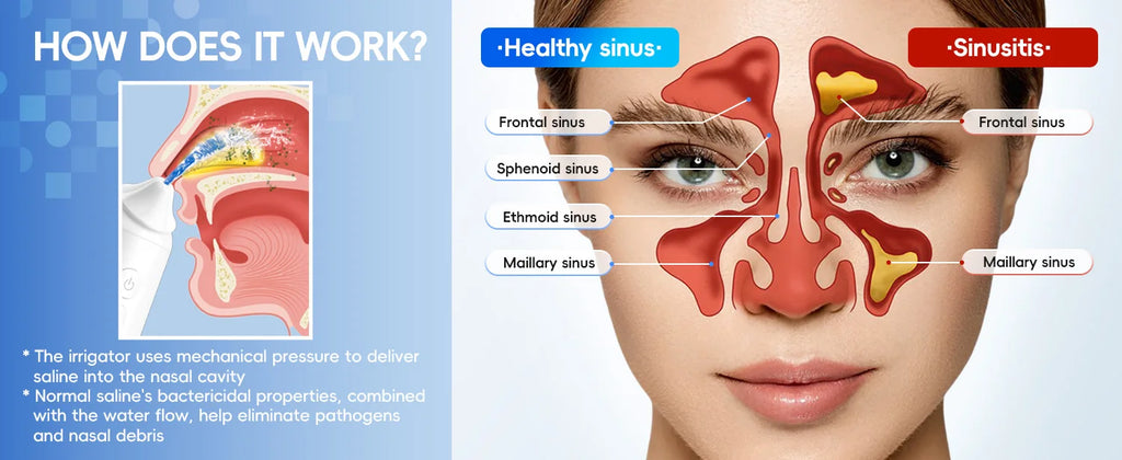 Electric Nasal Irrigation System for Sinus Relief and Allergy Care