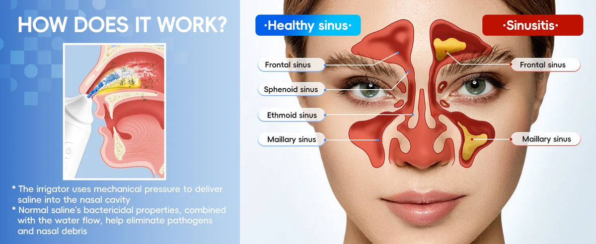 Electric Nasal Irrigation System for Sinus Relief and Allergy Care