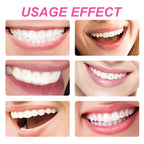 DIY Tooth Gem Kit for Sparkling Teeth Jewelry