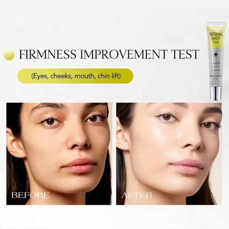 Retinal Shot Eye Serum 0.1% Retinal and 3% HA Firming Anti Aging Cream - 4