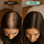 Microneedle Hair Regrowth and Scalp Nourishing Serum Kit