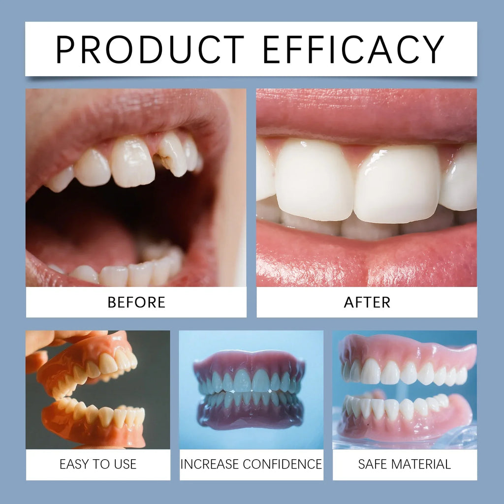 Temporary Realistic Denture Set for Missing Teeth and Gaps