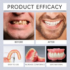 Cosmetic Silicone Dentures for Natural Smile