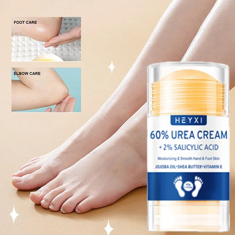 Heyxi 60 Percent Urea Cream Moisturizing Hand and Foot Repair Balm - 3