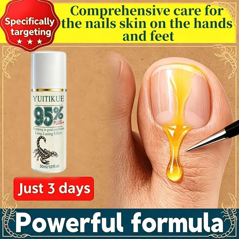 YUITIKUE Nail Repair Serum Hydrating Cuticle Oil for Stronger Nails - 12