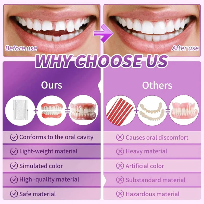 Comfort Fit Silicone Dentures for Instant Smile Enhancement