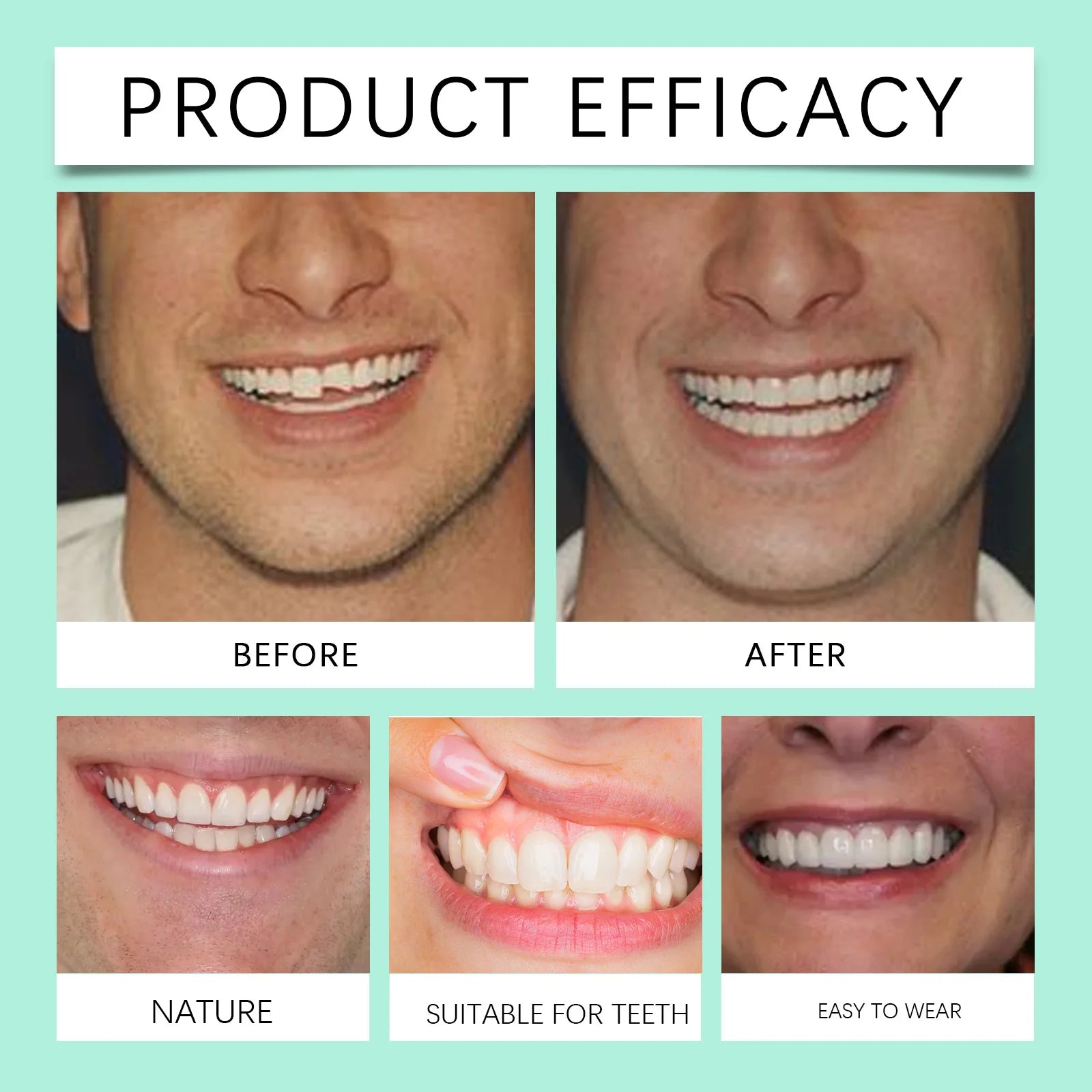 Flexible Silicone Cosmetic Dentures for Natural Smile - 12