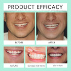 Flexible Silicone Cosmetic Dentures for Natural Smile