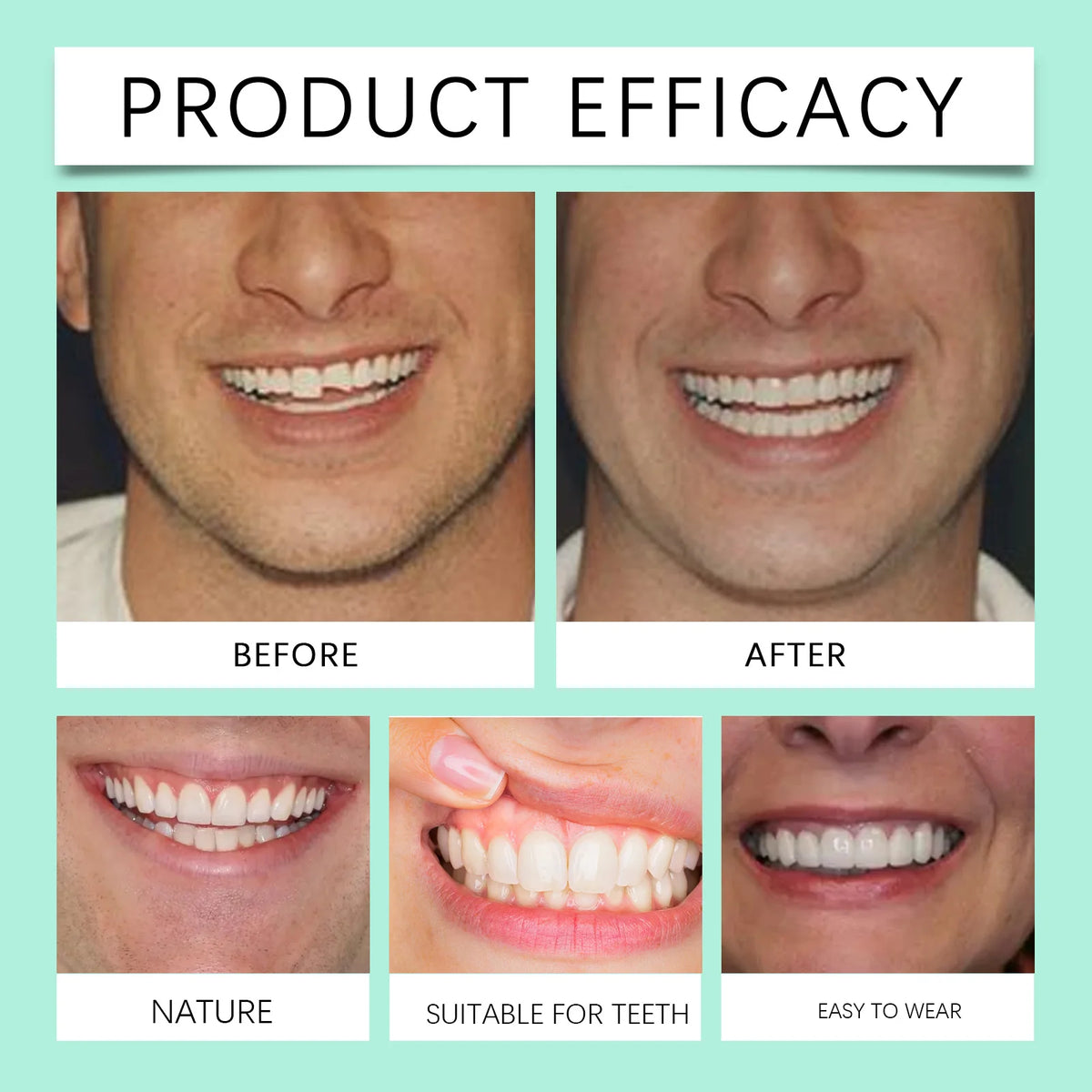 Flexible Silicone Cosmetic Dentures for Natural Smile