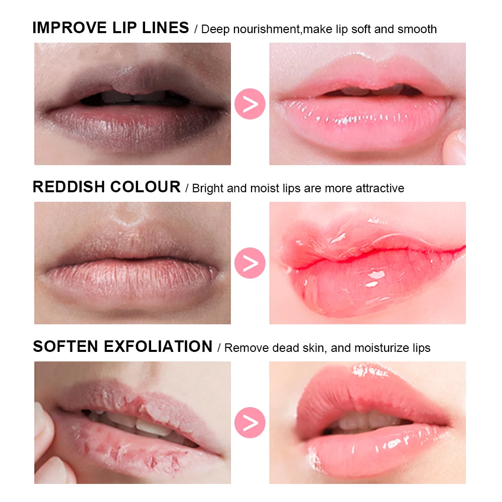 Moisturizing Lip Balm and Sleeping Mask Set - 3