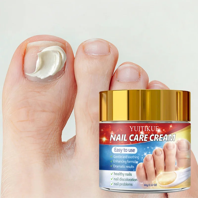 Yuitikue Nail Repair Cream 60g for Discolored and Damaged Nails
