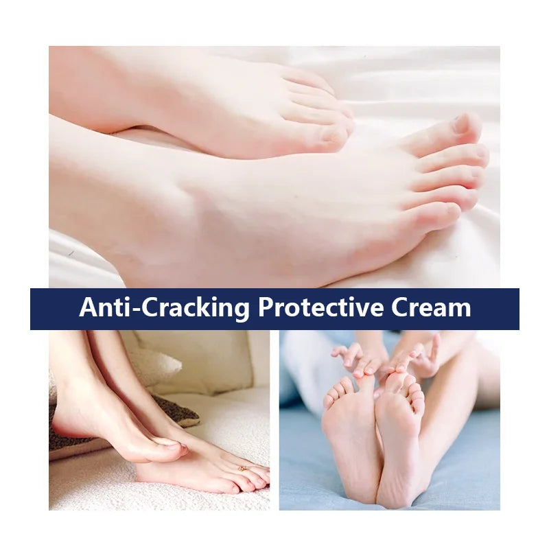 60 Percent Urea Foot Cream Salicylic Acid Repair for Cracked Heels