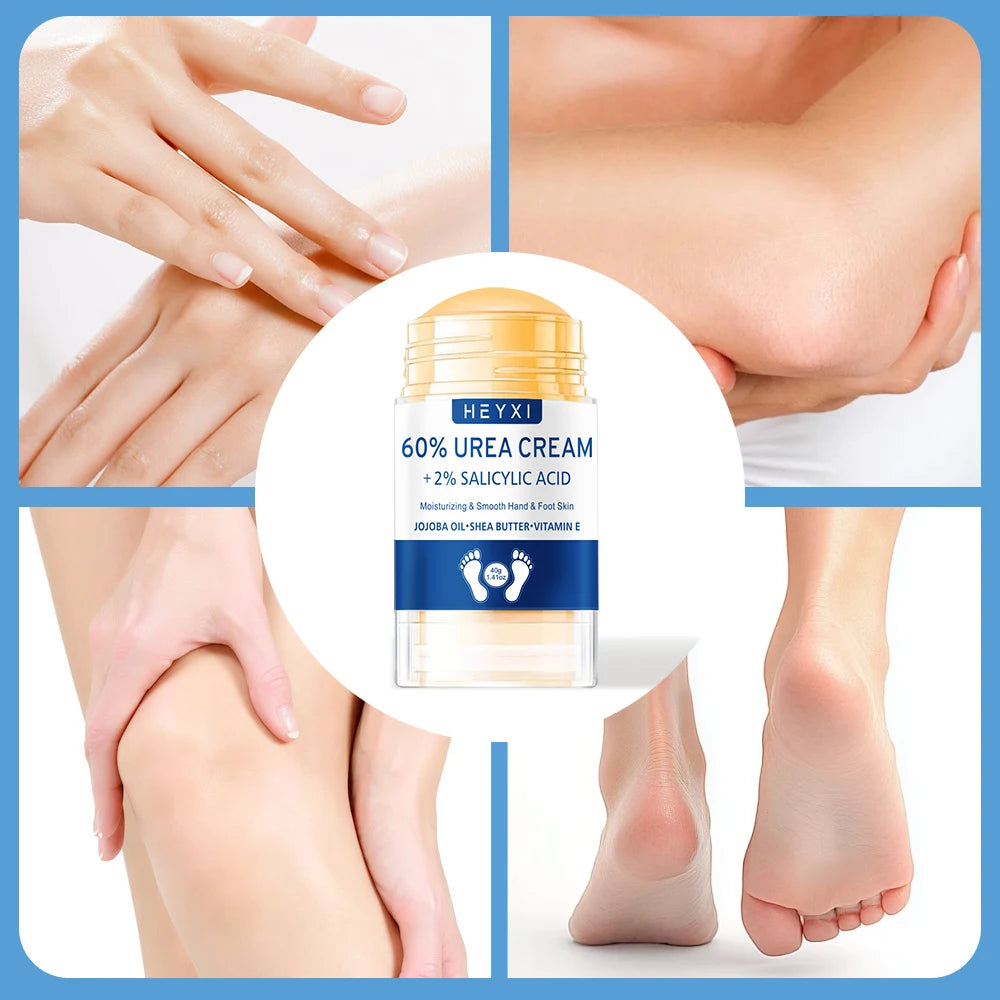 Heyxi 60 Percent Urea Cream Moisturizing Hand and Foot Repair Balm - 12