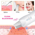 Ultrasonic Skin Scrubber Facial Pore Cleaner Blackhead Remover Device