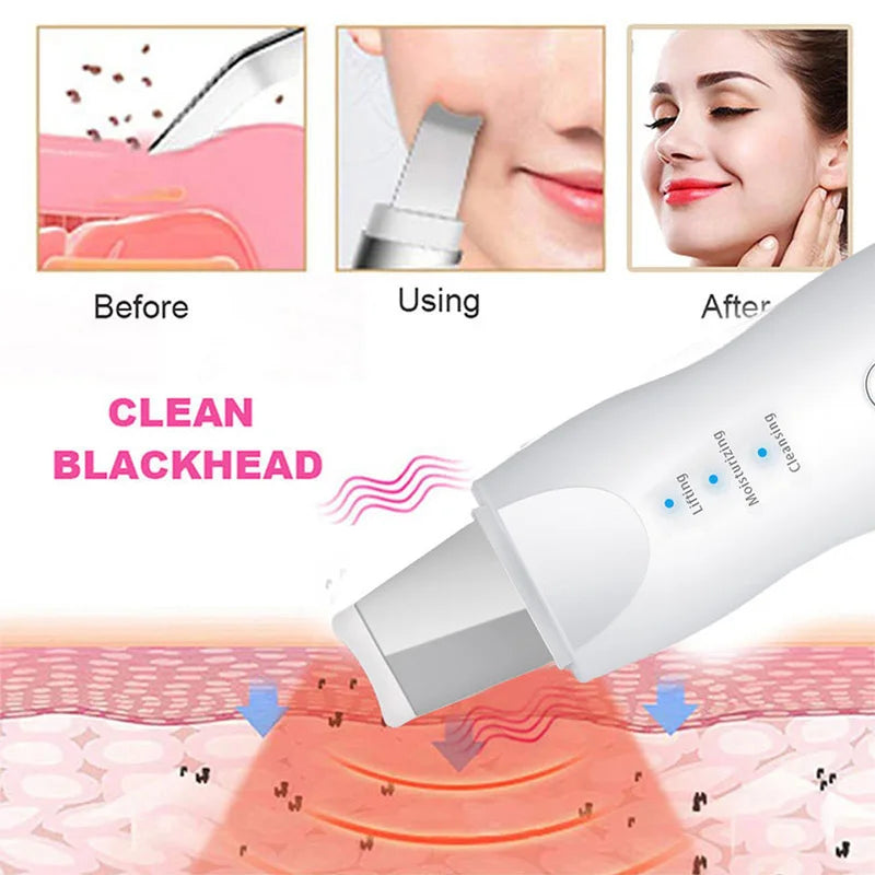 Ultrasonic Skin Scrubber Facial Pore Cleaner Blackhead Remover Device