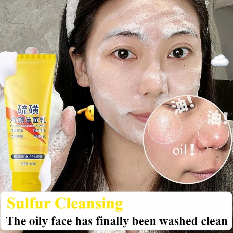 Sulfur Facial Cleanser Acne Control Oil Balancing Face Wash