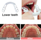 Snap On Smile Veneers Cosmetic Teeth Whitening Denture Set