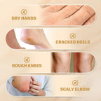 Urea Cream 60g Cracked Heel Repair Moisturizer for Dry Skin Hands Feet