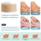 Silicone Scar Removal Tape for Surgery and Burn Scars
