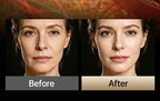 LED Facial and Body Skin Tightening and Sculpting Device