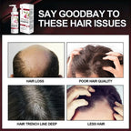 Onion and Olive Hair Strengthening Shampoo with Biotin and Rosemary Oil