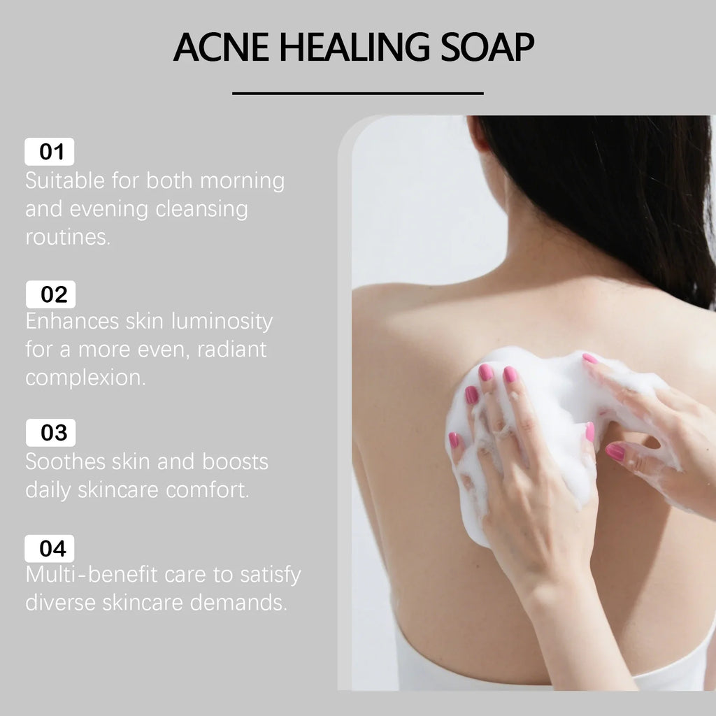 Turmeric Bar Soap for Back and Body Acne Treatment and Skin Brightening