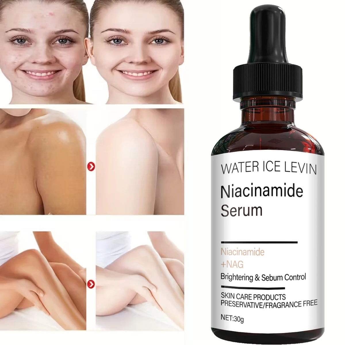 Water Ice Levin Niacinamide Serum Brightening and Oil Control Formula