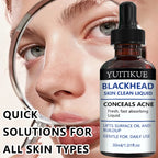 YUITIKUE Blackhead Remover Serum Pore Refining Face Treatment 30ml