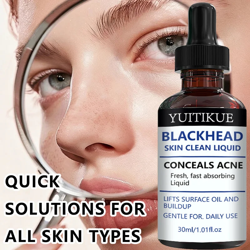 YUITIKUE Blackhead Remover Serum Pore Refining Face Treatment 30ml