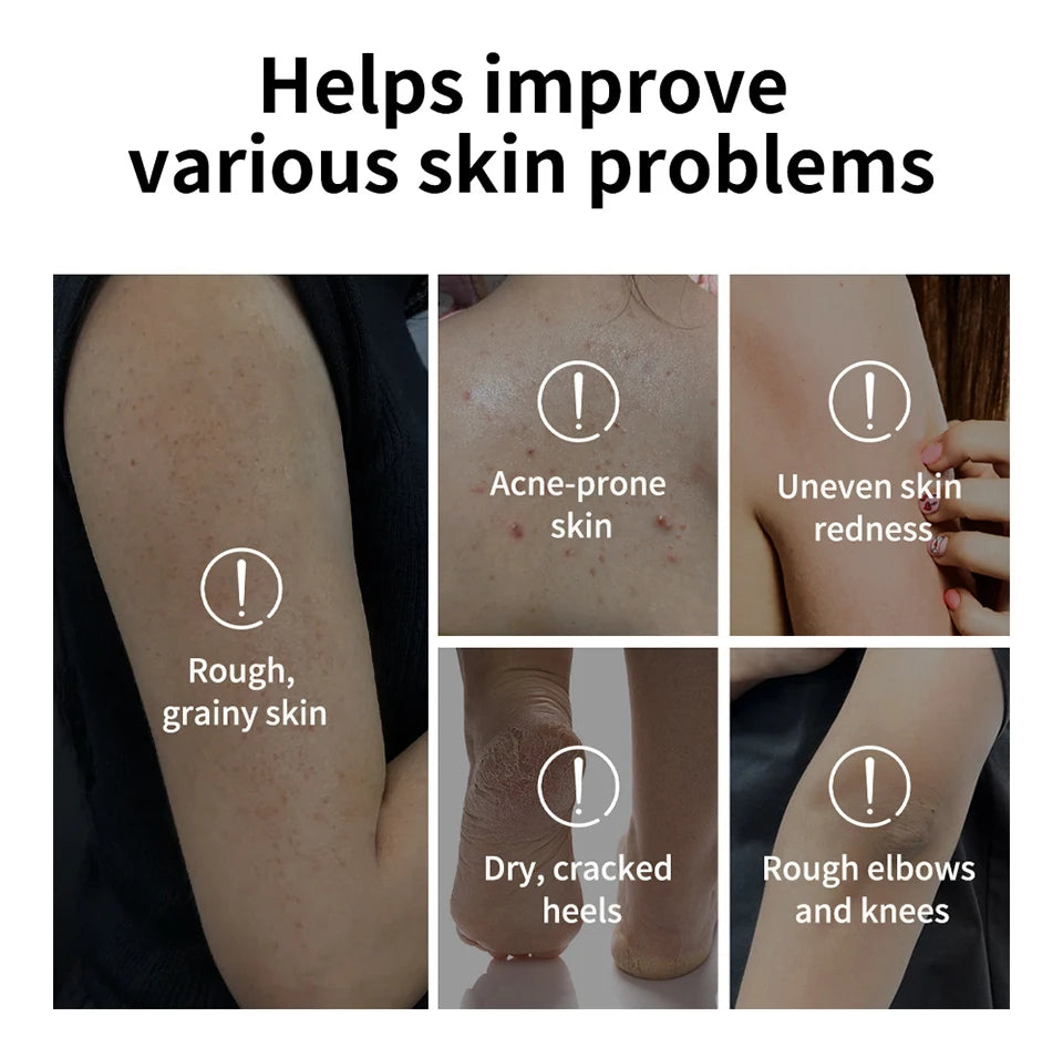 Glycolic Acid Exfoliating Body Treatment Stick