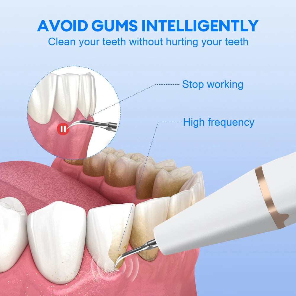 Ultrasonic Electric Teeth Tartar and Plaque Remover