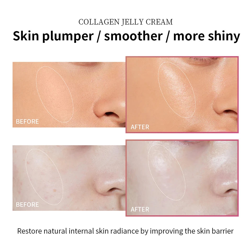 Collagen Jelly Face Cream for Deep Hydration and Skin Firming