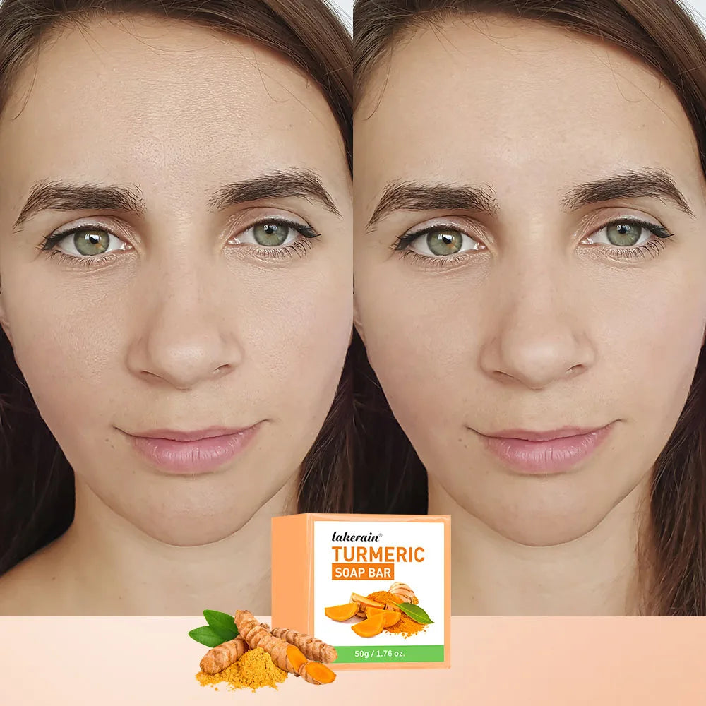 Turmeric Kojic Acid Brightening Soap Bar for Face and Body