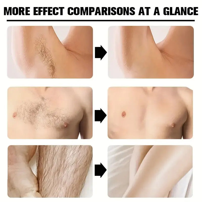 YUITIKUE Painless Hair Removal Cream for Men Body Hair Remover Lotion - 5