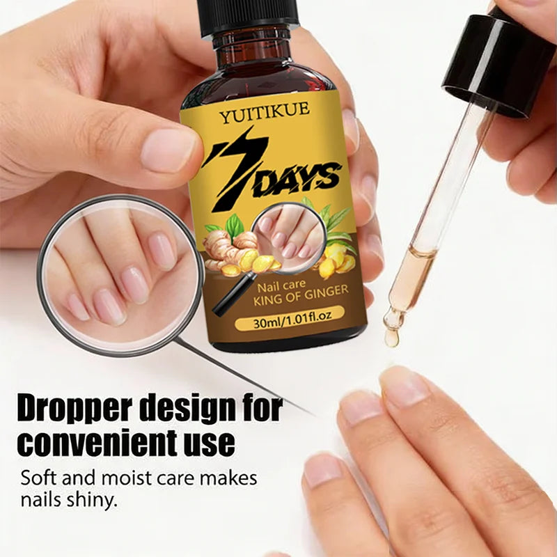 YUITIKUE Ginger Nail Care Oil - Nourishing Cuticle Treatment 30ml - 5